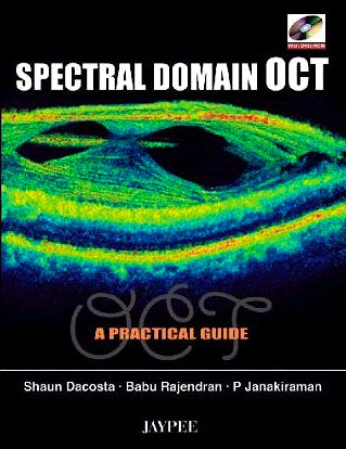 Portada del libro 9788184483116 Spectral Domain Oct. a Practical Guide + Dvd-Rom