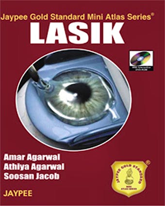 Portada del libro 9788184485295 Lasik (Jaypee Gold Standard Mini Atlas Series)