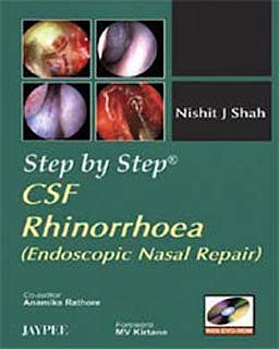 Portada del libro 9788184485936 Step by Step Csf Rhinorrhoea (Endoscopic Nasal Repair) + Dvd-Rom