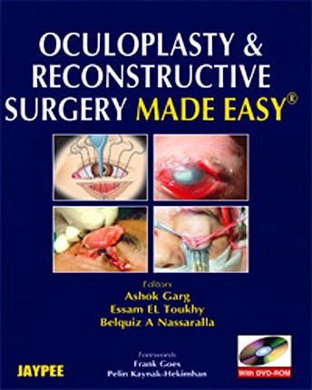 Portada del libro 9788184485967 Oculoplasty and Reconstructive Surgery Made Easy