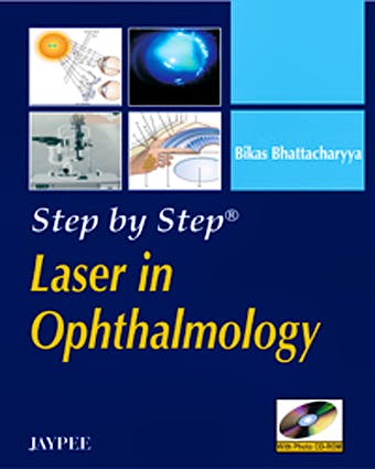 Portada del libro 9788184486070 Step by Step Laser in Ophthalmology + Cd-Rom