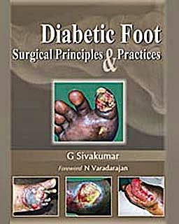 Portada del libro 9788184487398 Diabetic Foot. Surgical Principles and Practices
