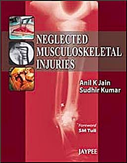 Portada del libro 9788184488890 Neglected Musculoskeletal Injuries
