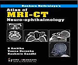 Portada del libro 9788184489002 Atlas of MRI-CT. Neuro-Ophthalmology