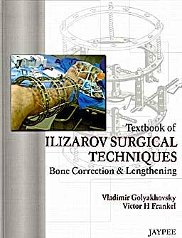 Portada del libro 9788184489330 Textbook of Ilizarov Surgical Techniques. Bone Correction & Lengthening