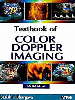 Portada del libro 9788184489965 Textbook of Colour Doppler Imaging