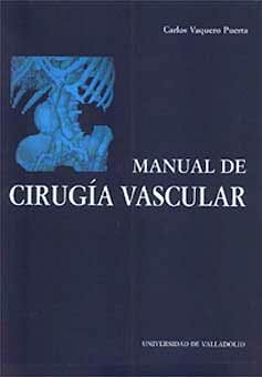 Portada del libro 9788400000004 Manual de Cirugia Vascular
