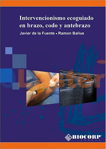 Portada del libro 9788409333820 Intervencionismo Ecoguiado en Brazo, Codo y Antebrazo