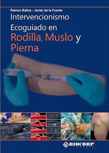 Portada del libro 9788409544127 Intervencionismo Ecoguiado en Rodilla, Muslo y Pierna