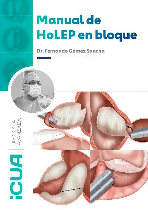 Portada del libro 9788409818884 Manual de HoLEP en Bloque