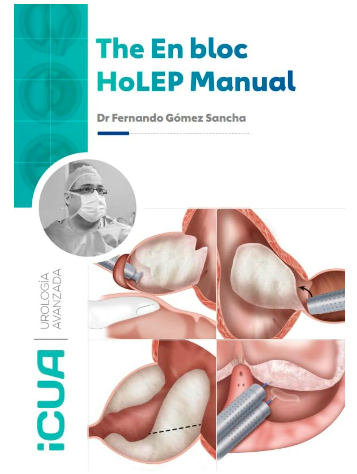 Portada del libro 9788409820344 The En Bloc HOLEP Manual