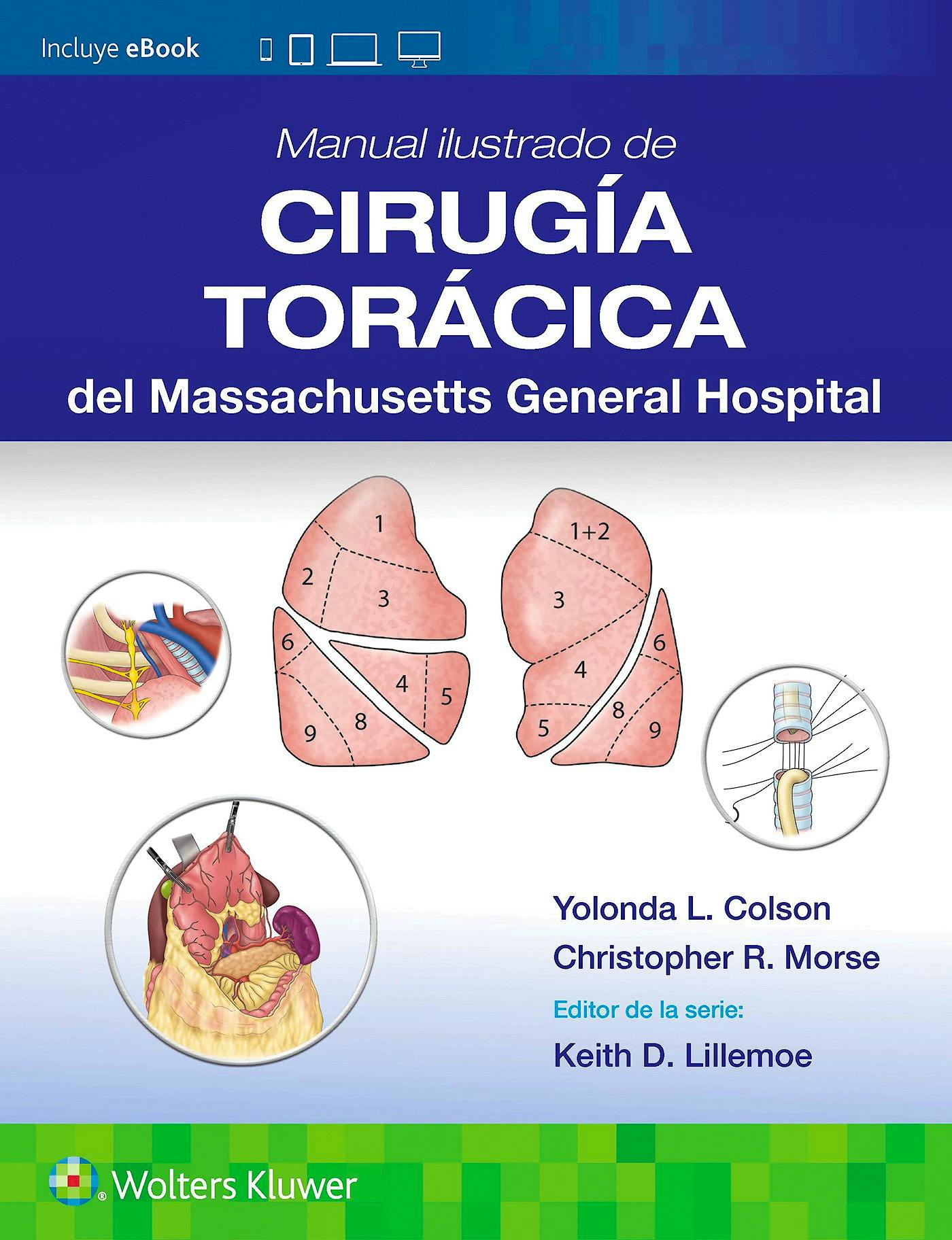 Portada del libro 9788410870161 Manual Ilustrado de Cirugía Torácica del MASSACHUSETTS GENERAL HOSPITAL