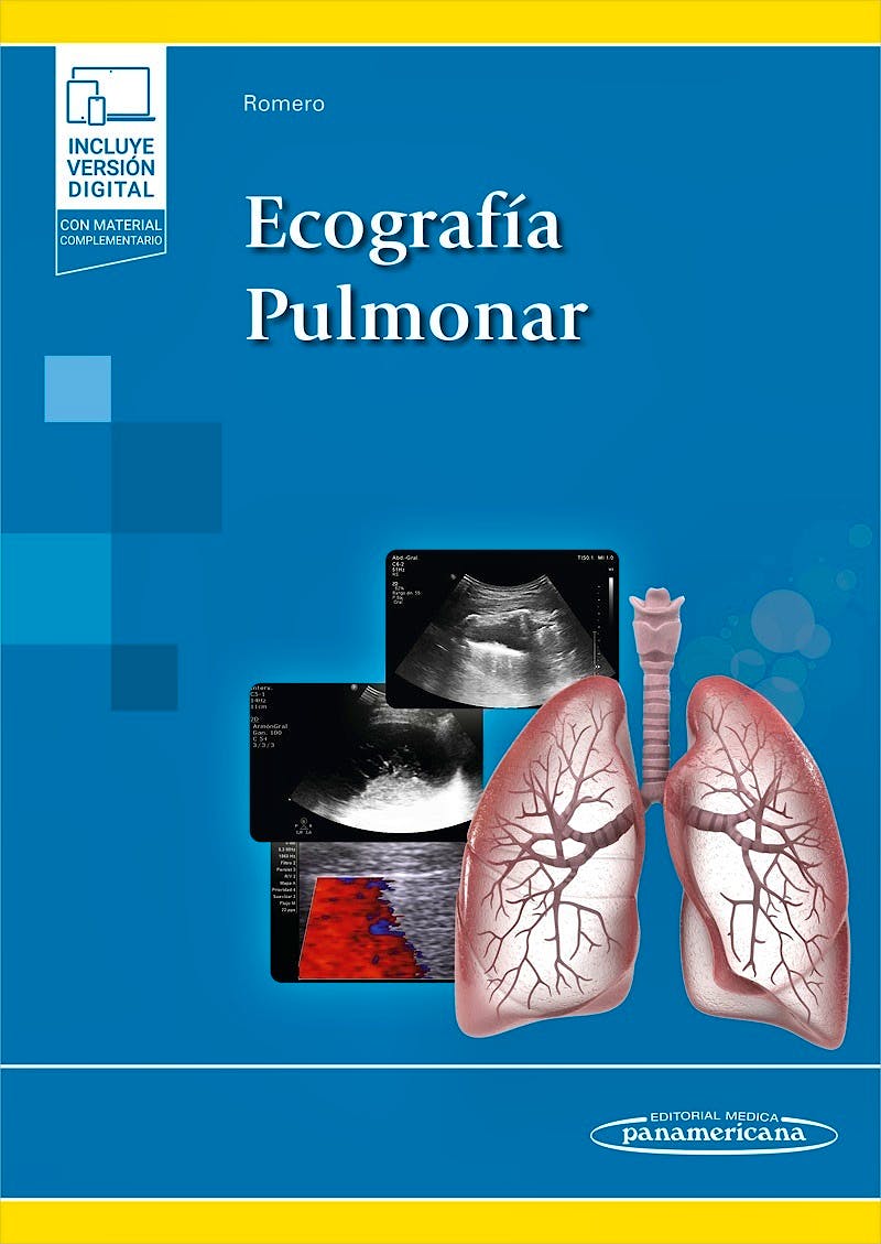 Ecografía Pulmonar