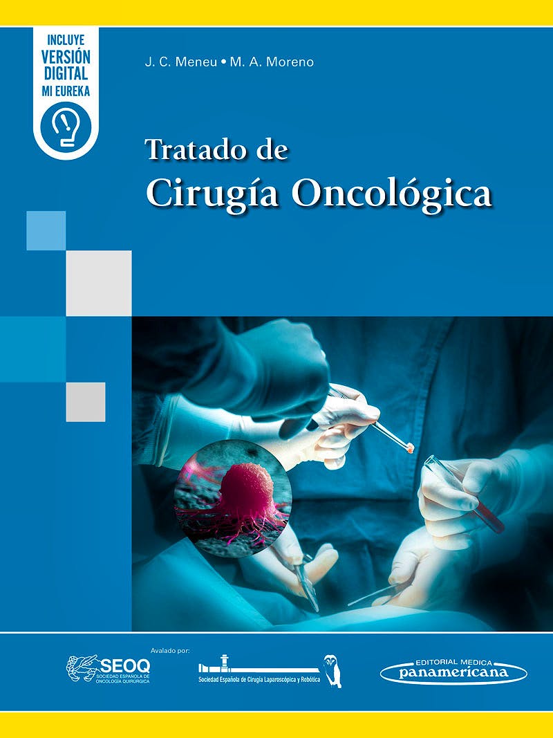 Portada del libro 9788411061209 Tratado de Cirugía Oncológica