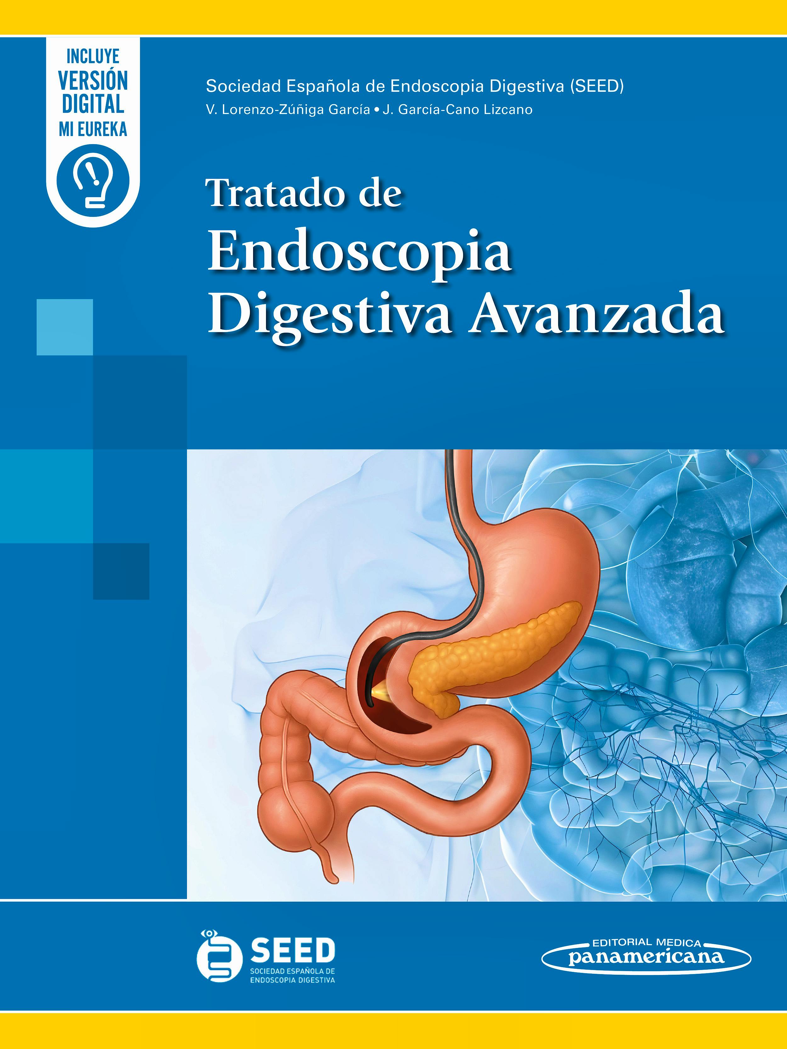 Portada del libro 9788411062411 Tratado de Endoscopia Digestiva Avanzada