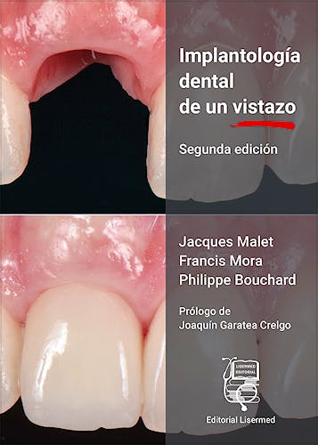 Portada del libro 9788412563849 Implantología Dental de un Vistazo