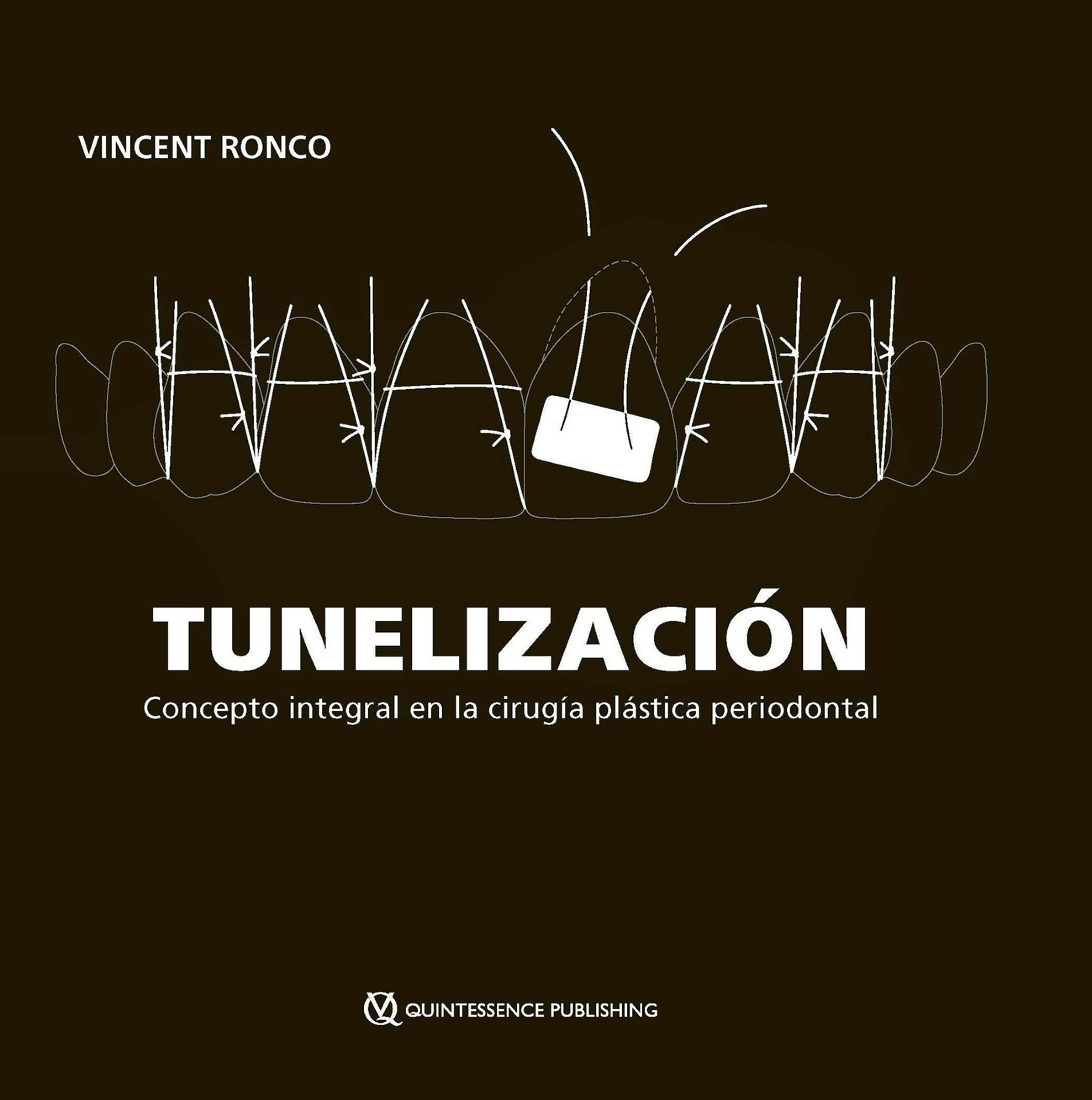 Portada del libro 9788412898255 TUNELIZACIÓN. Concepto Integral en la Cirugía Plástica Periodontal