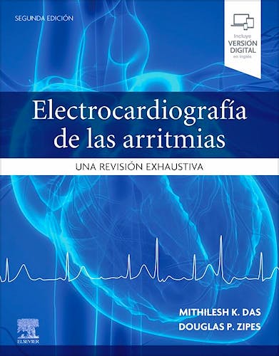 Electrocardiografía de las Arritmias. Una Revisión Exhaustiva
