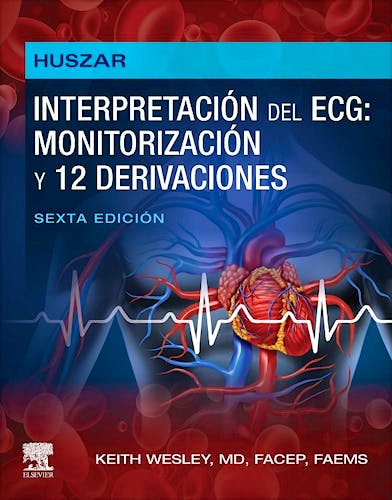 HUSZAR Interpretación del ECG: Monitorización y 12 Derivaciones