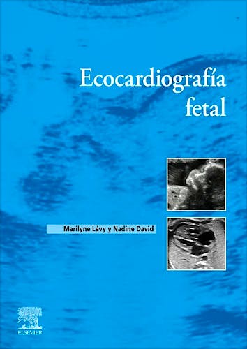 Ecocardiografía Fetal