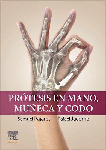 Prótesis en Mano, Muñeca y Codo