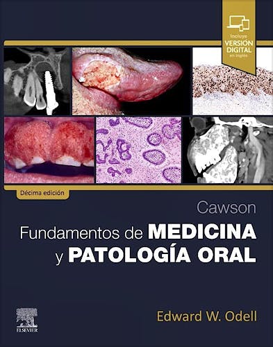 Portada del libro 9788413828169 CAWSON Fundamentos de Medicina y Patología Oral
