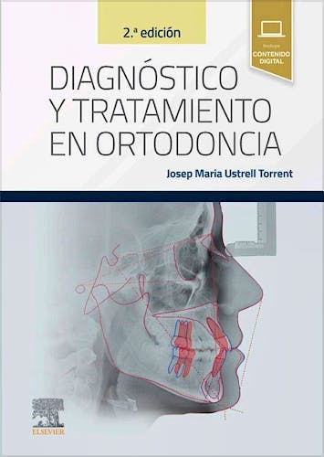 Diagnóstico y Tratamiento en Ortodoncia