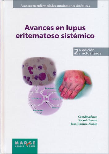 Portada del libro 9788415340201 Avances en Lupus Eritematoso Sistémico (Avances en Enfermedades Autoinmunes Sistémicas, Vol. 1)