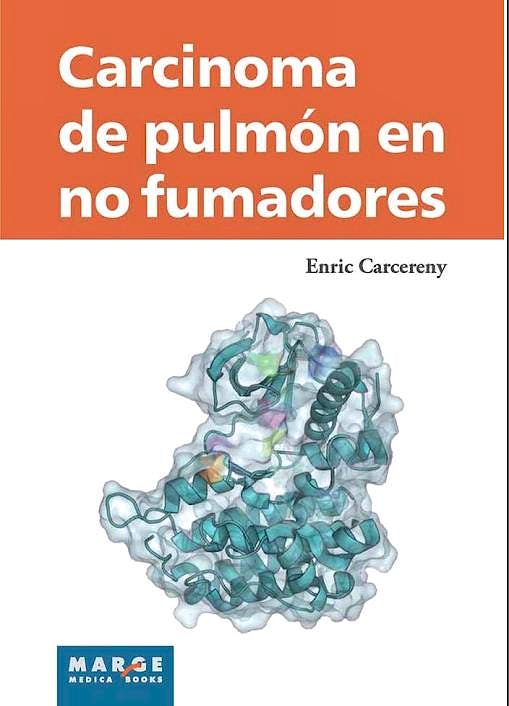 Portada del libro 9788415340706 Carcinoma de Pulmon en no Fumadores
