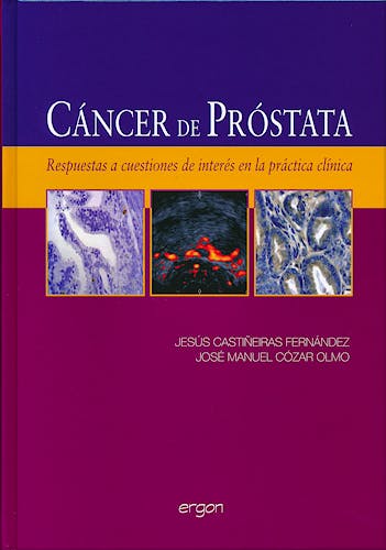 Portada del libro 9788415351375 Cáncer de Próstata. Respuestas a Cuestiones de Interés en la Práctica Clínica