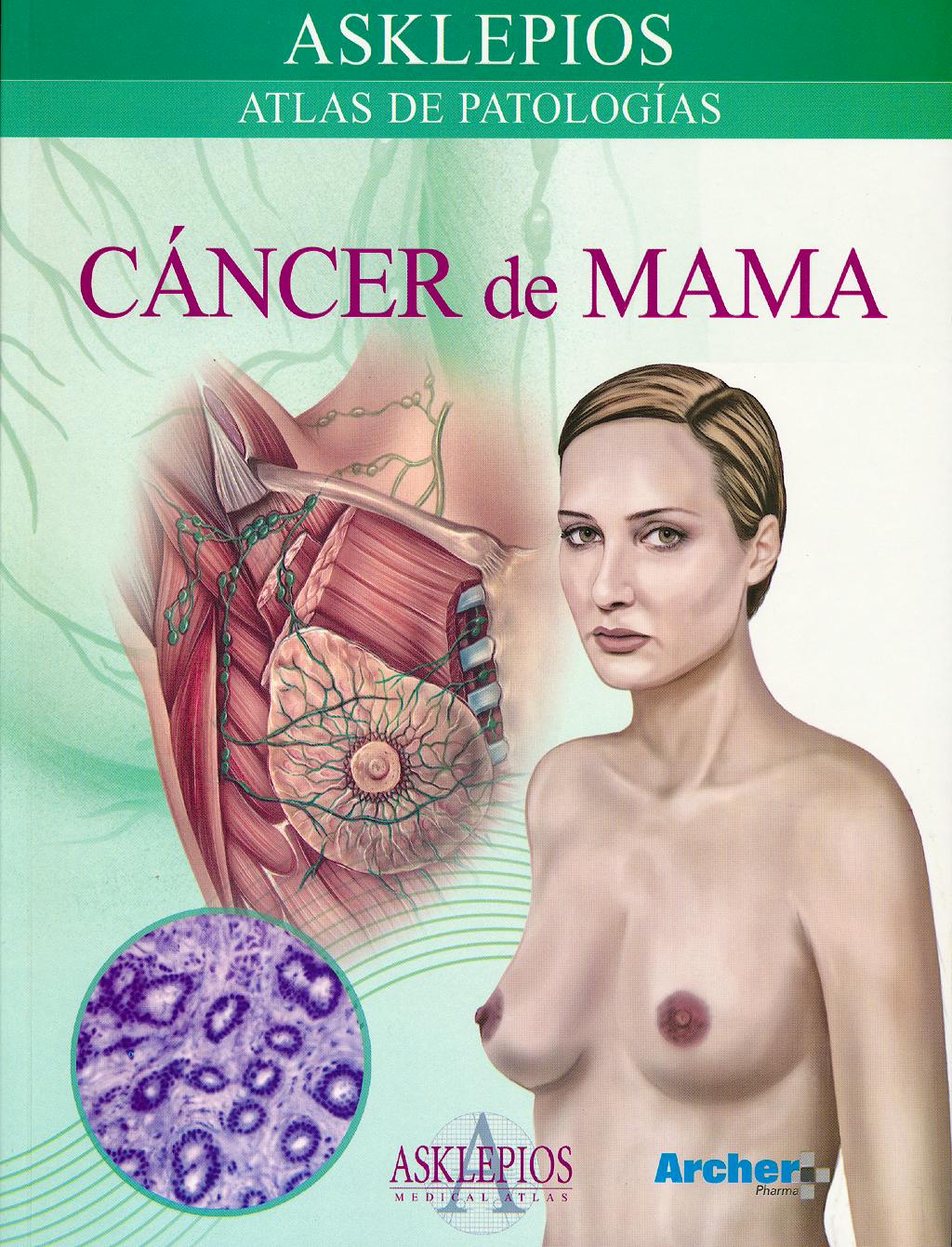 Portada del libro 9788415351450 Cancer de Mama. Atlas de Patologia (Asklepios)