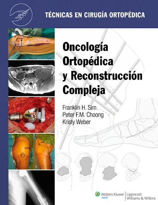 Portada del libro 9788415419990 Oncología Ortopédica y Reconstrucción Compleja + Acceso Online. Técnicas en Cirugía Ortopédica