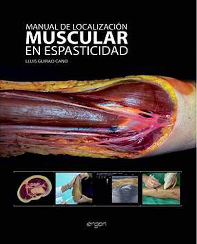Portada del libro 9788415950172 Manual de Localización Muscular en Espasticidad