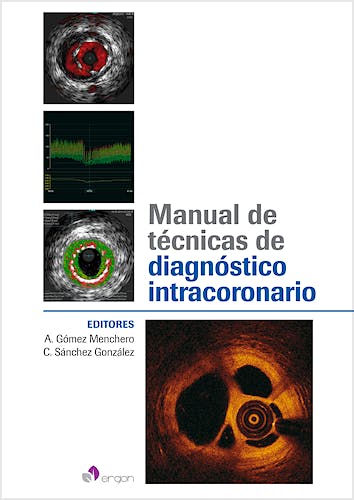 Portada del libro 9788415950684 Manual de Técnicas de Diagnóstico Intracoronario