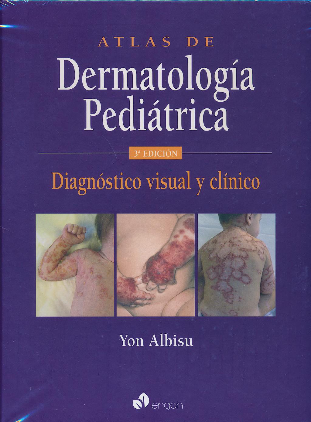 Portada del libro 9788415950851 Atlas de Dermatología Pediátrica. Diagnóstico Visual y Clínico