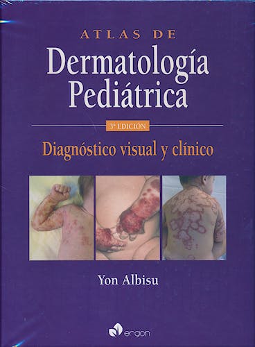 Portada del libro 9788415950851 Atlas de Dermatología Pediátrica. Diagnóstico Visual y Clínico
