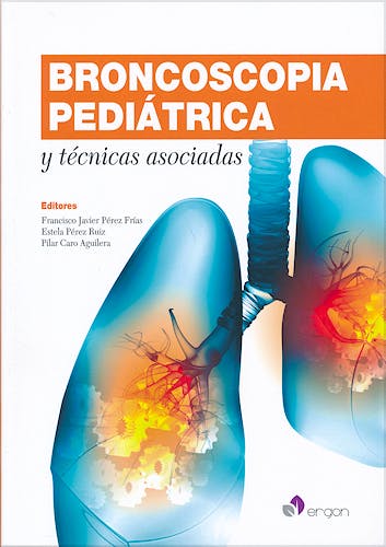 Portada del libro 9788415950974 Broncoscopia Pediátrica y Técnicas Asociadas + CD