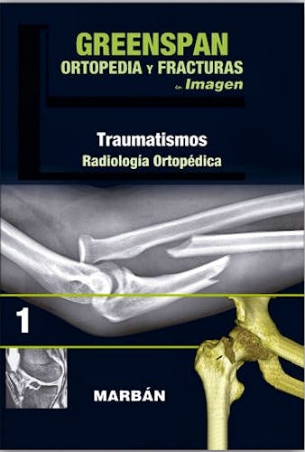 Portada del libro 9788416042173 Ortopedia y Fracturas en Imagen, Vol. 1: Traumatismos, Radiología Ortopédica