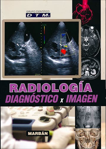 Portada del libro 9788416042227 Radiología. Diagnóstico por Imagen (Flexilibro)