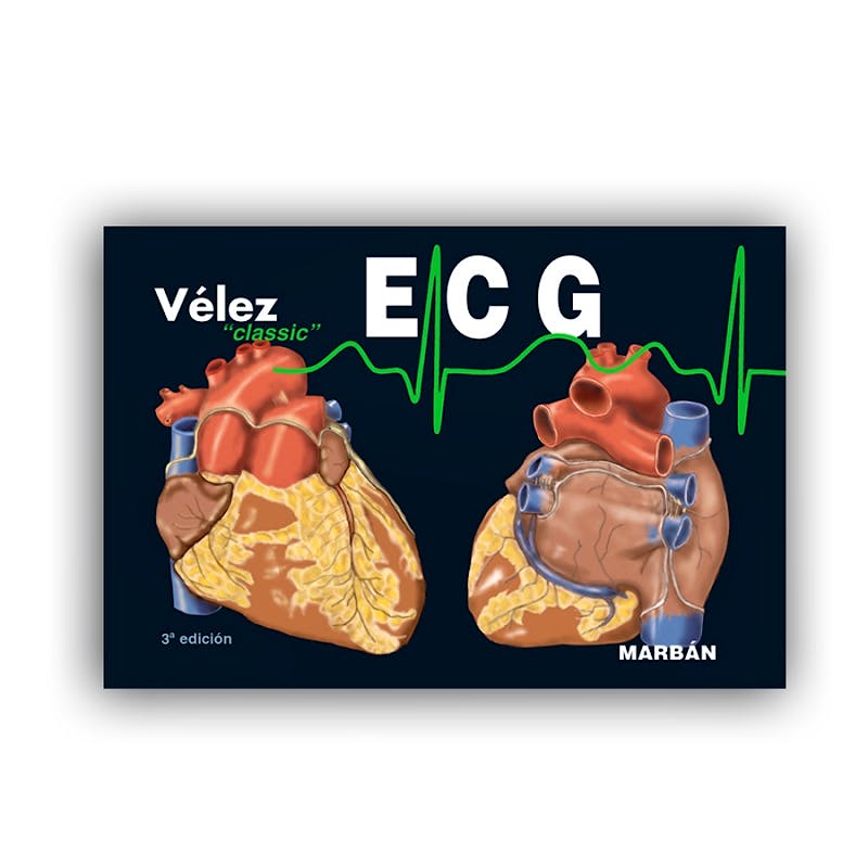 Portada del libro 9788416042418 ECG Electrocardiografía (Edición Pequeño)