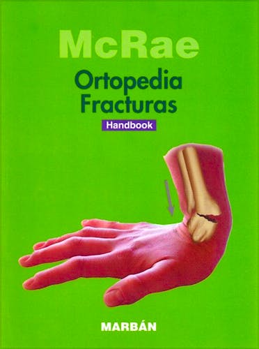 Portada del libro 9788416042647 Ortopedia y Fracturas (Handbook)