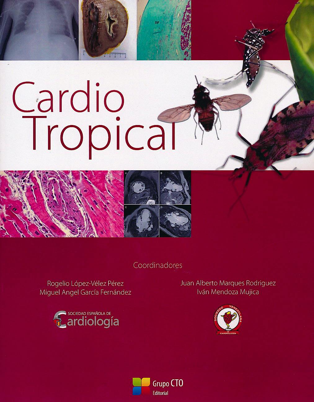 Portada del libro 9788416153855 Cardio Tropical