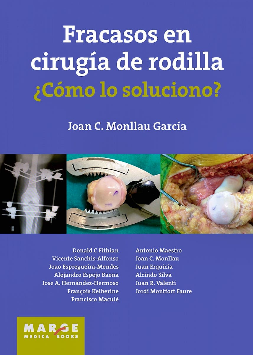 Portada del libro 9788416171118 Fracasos en Cirugía de Rodilla ¿Cómo lo Soluciono?