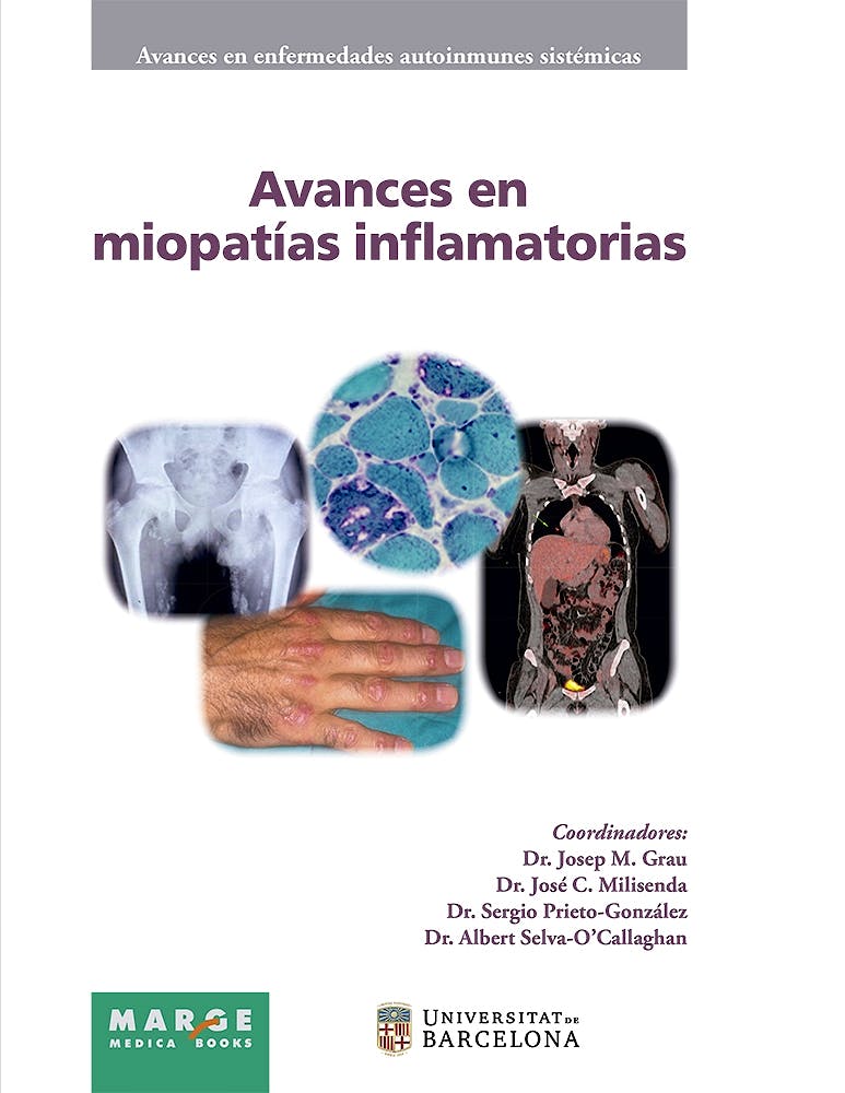 Portada del libro 9788416171330 Avances en Miopatías Inflamatorias (Avances en Enfermedades Autoinmunes Sistémicas, Vol. 7)