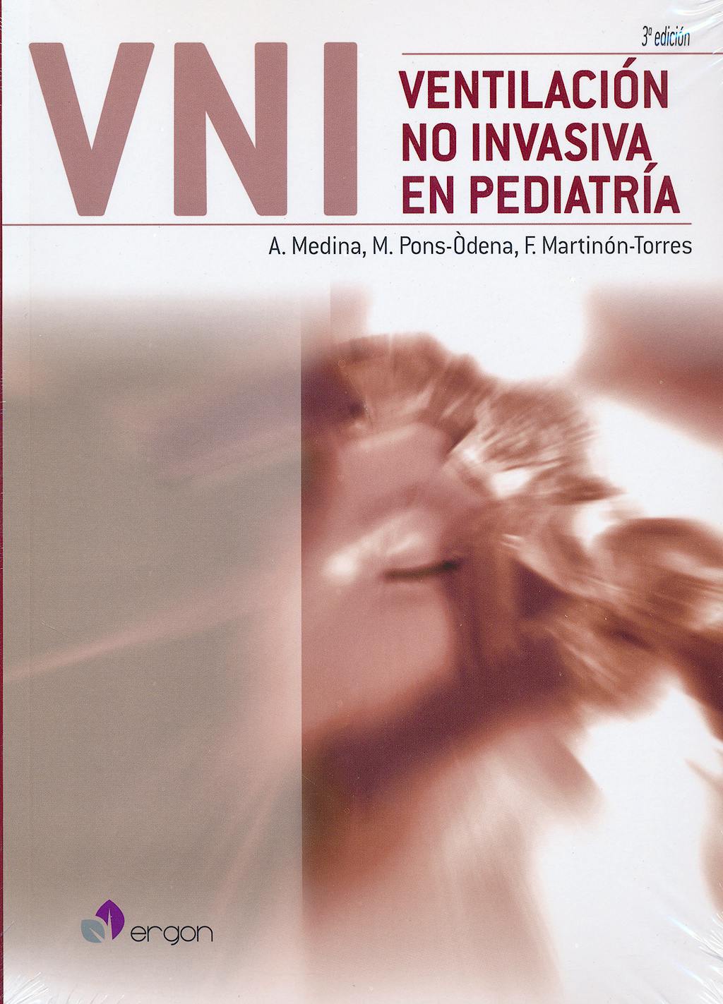 Ventilacion No Invasiva En Pediatria: 9788416270309: Medina, A. — Pons ...