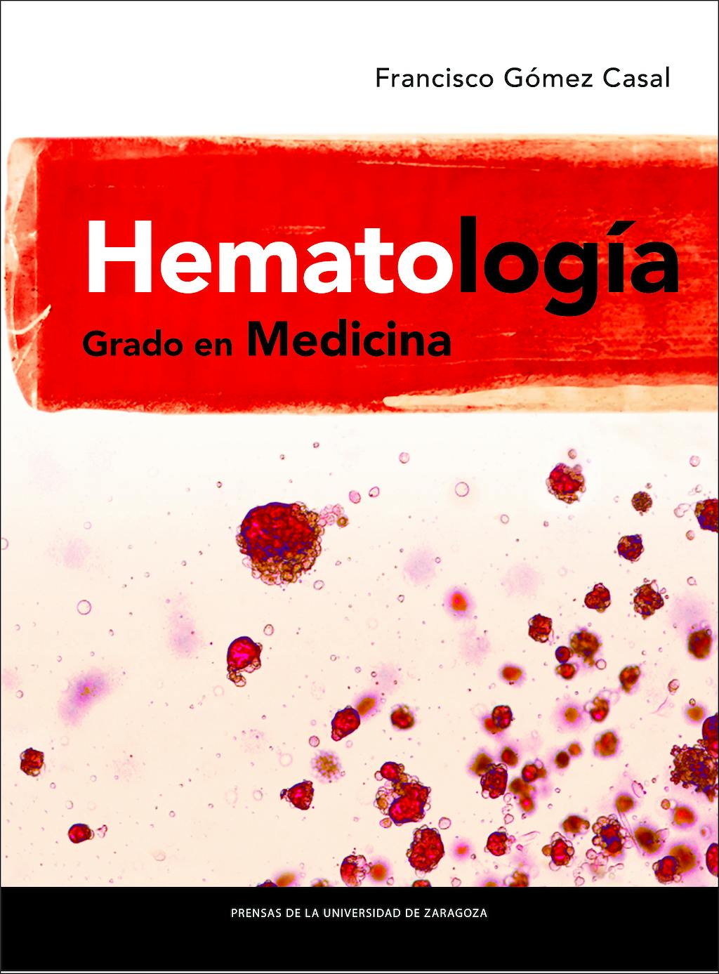 Portada del libro 9788416515875 Hematología Grado en Medicina