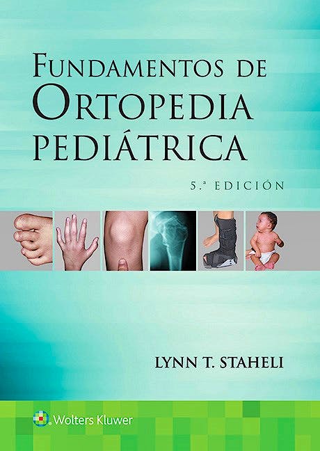 Portada del libro 9788416654482 Fundamentos de Ortopedia Pediátrica