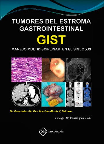 Portada del libro 9788417010522 Tumores del Estroma Gastrointestinal (GIST). Manejo Multidisciplinar en el Siglo XXI