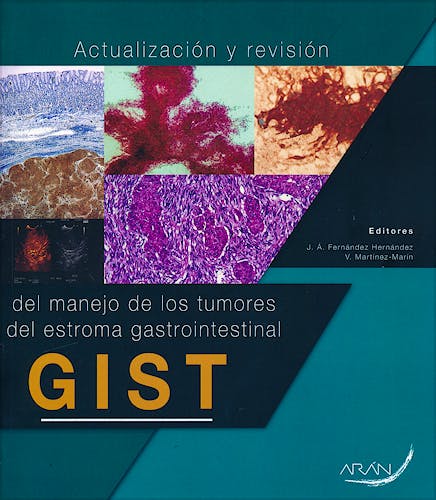 Portada del libro 9788417046569 Actualización y Revisión del Manejo de los Tumores del Estroma Gastrointestinal (GIST)