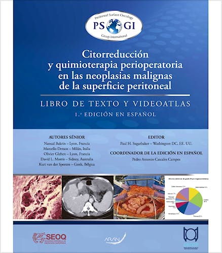 Portada del libro 9788417046897 Citorreducción y Quimioterapia Perioperatoria en las Neoplasias Malignas de la Superficie Peritoneal. Libro de Texto y Videoatlas
